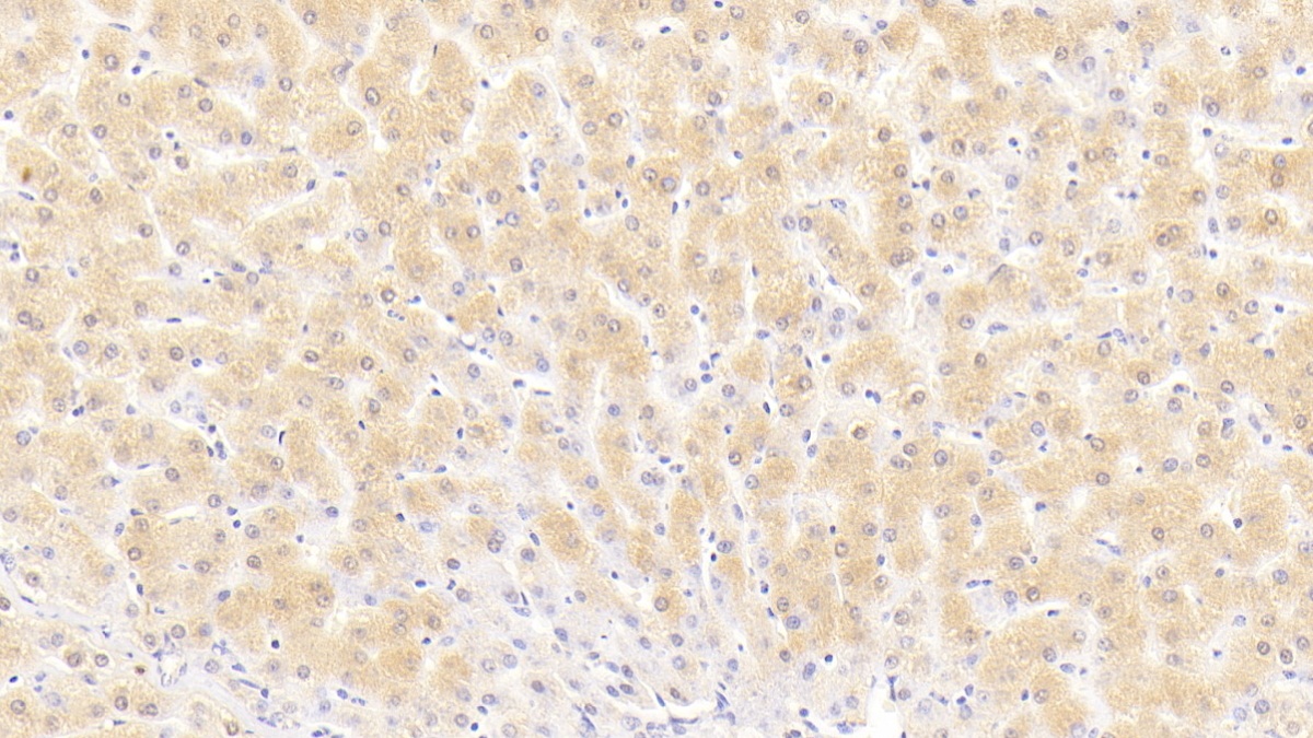 Polyclonal Antibody to Puromycin Sensitive Aminopeptidase (PSA)