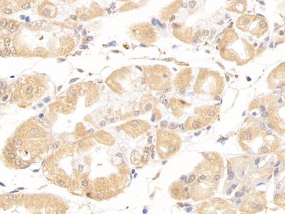 Polyclonal Antibody to Puromycin Sensitive Aminopeptidase (PSA)