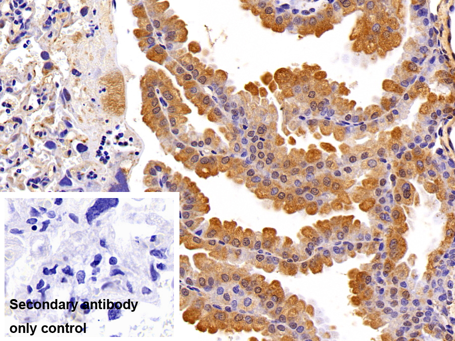 Polyclonal Antibody to Puromycin Sensitive Aminopeptidase (PSA)