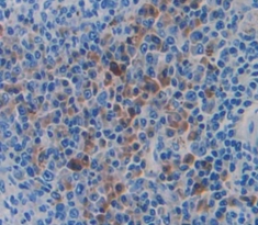 Polyclonal Antibody to Elastase 2A (ELA2A)