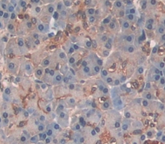 Polyclonal Antibody to Elastase 3B (ELA3B)