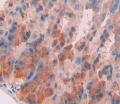 Polyclonal Antibody to Elastase 3B (ELA3B)