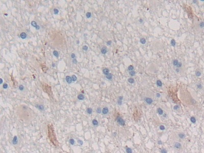 Polyclonal Antibody to Chymotrypsinogen B1 (CTRB1)