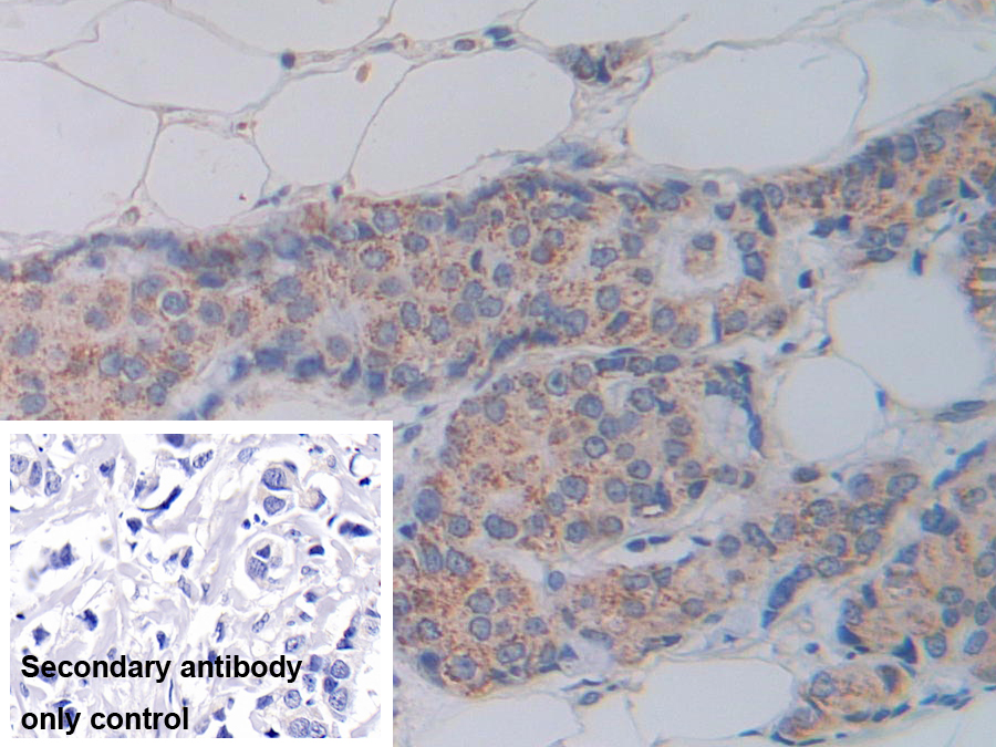 Polyclonal Antibody to Serine Hydroxymethyltransferase 2, Mitochondrial (SHMT2)