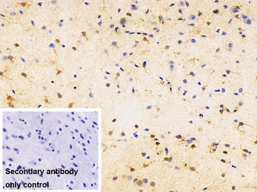 Polyclonal Antibody to Peptidyl Prolyl Cis/Trans Isomerase NIMA Interacting Protein 1 (PIN1)