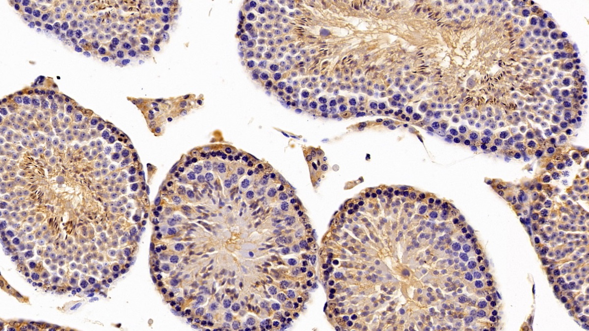 Polyclonal Antibody to Beta-Carotene-15,15'-Monooxygenase 1 (bCMO1)