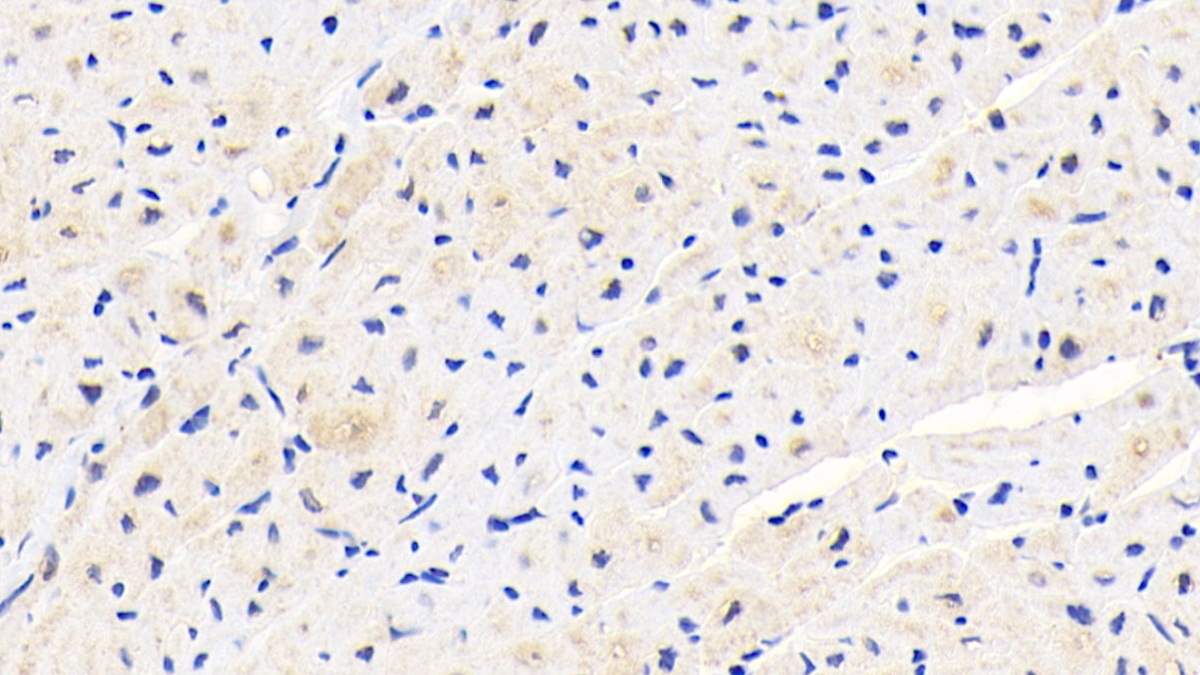 Polyclonal Antibody to Procollagen Lysine-1,2-Oxoglutarate-5-Dioxygenase 1 (PLOD1)