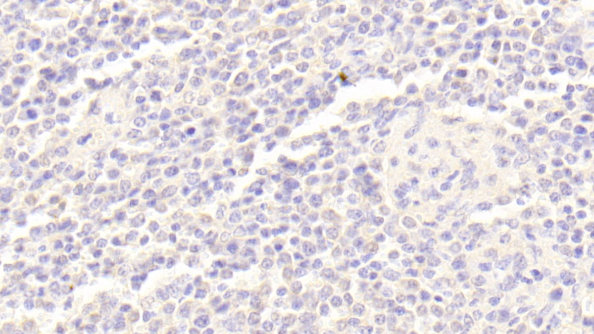 Polyclonal Antibody to B-Lymphoid Tyrosine Kinase (BLK)