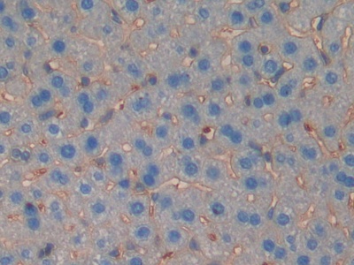 Polyclonal Antibody to Muscle, Skeletal, Receptor Tyrosine Kinase (MUSK)