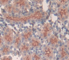 Polyclonal Antibody to Solute Carrier Family 3, Member 2 (SLC3A2)