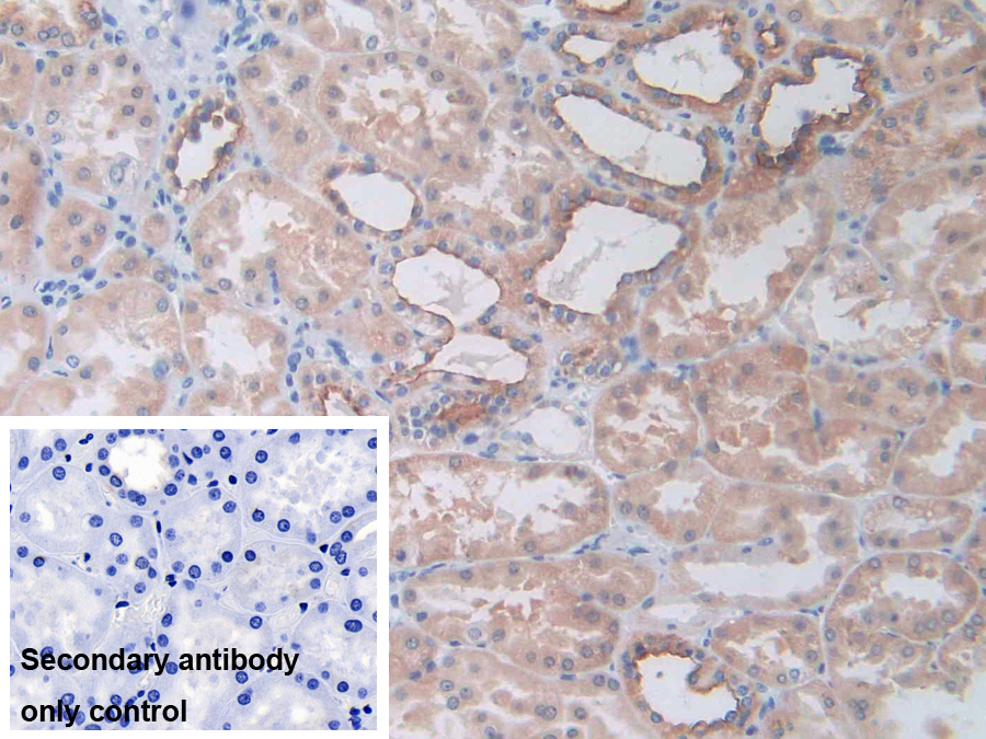 Polyclonal Antibody to Na-Cl Cotransporter (NCCT)