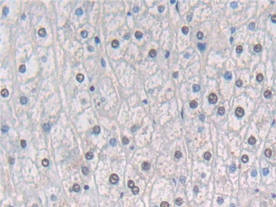 Polyclonal Antibody to Fyn Related Kinase (FRK)