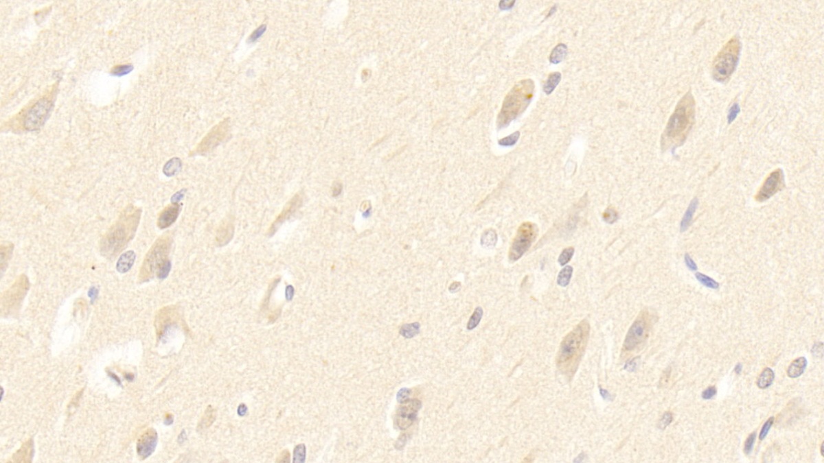 Polyclonal Antibody to Lemur Tyrosine Kinase 3 (LMTK3)