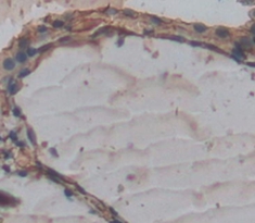 Polyclonal Antibody to Sodium Iodide Symporter (NIS)