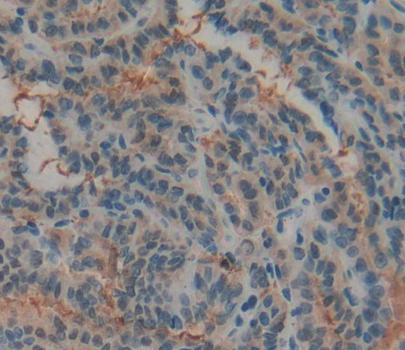 Polyclonal Antibody to Hydrogen Ion/Peptide Transporter 1 (HPEPT1)