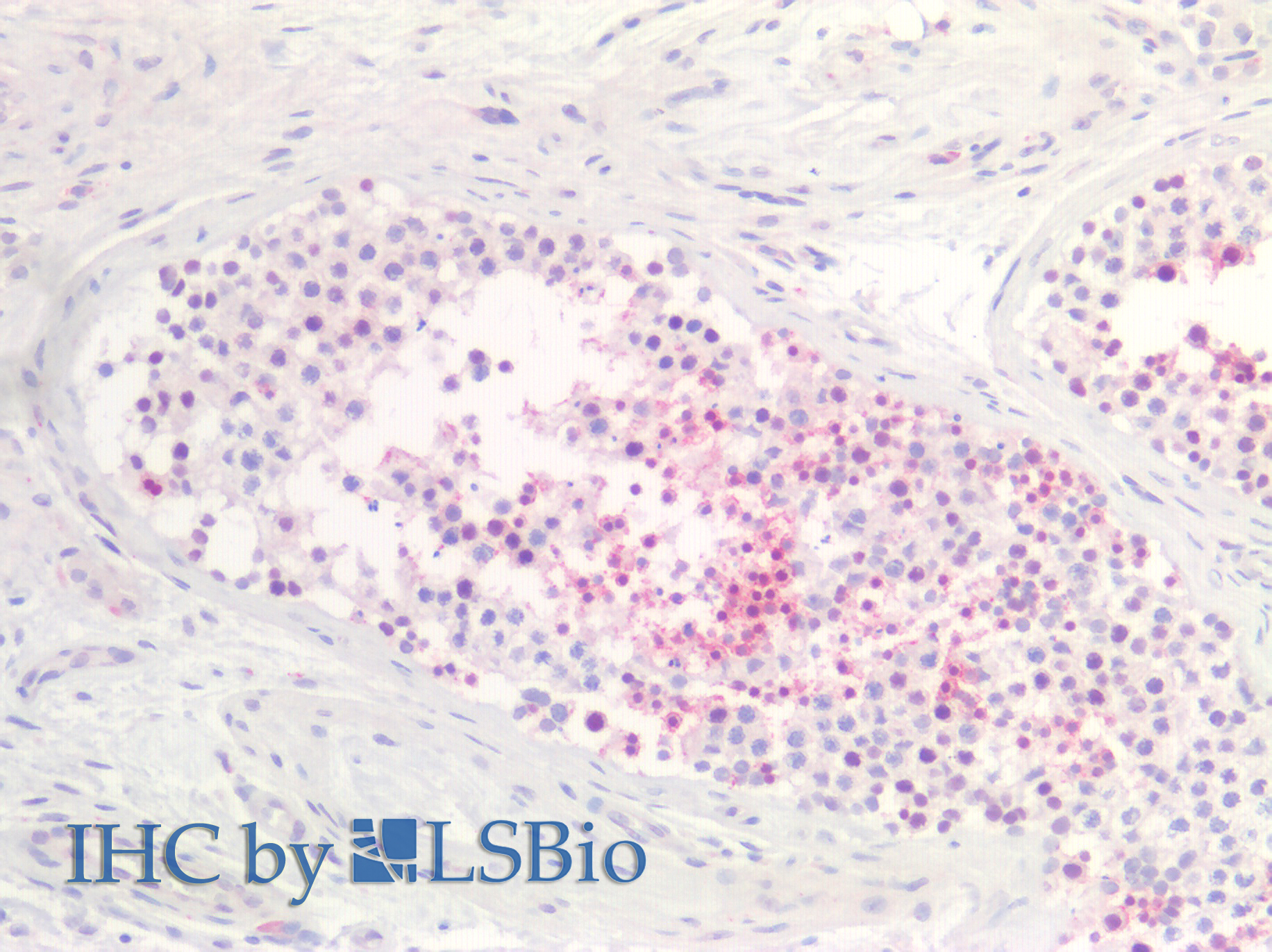 Polyclonal Antibody to Testis Anion Transporter 1 (TAT1)