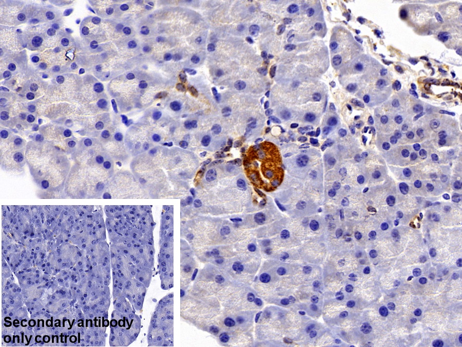 Polyclonal Antibody to Solute Carrier Family 30 Member 8 (SLC30A8)