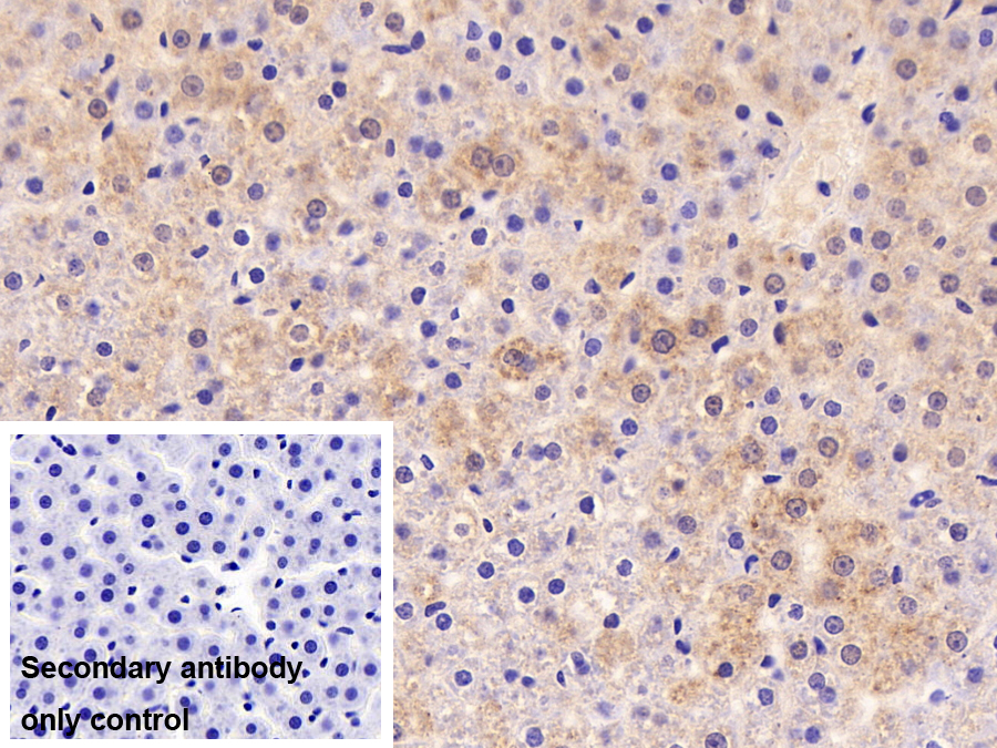 Polyclonal Antibody to Electron Transfer Flavoprotein Alpha Polypeptide (ETFa)