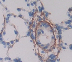 Polyclonal Antibody to Endothelial Cell Adhesion Molecule (ESAM)