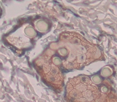 Polyclonal Antibody to Tafazzin (TAZ)