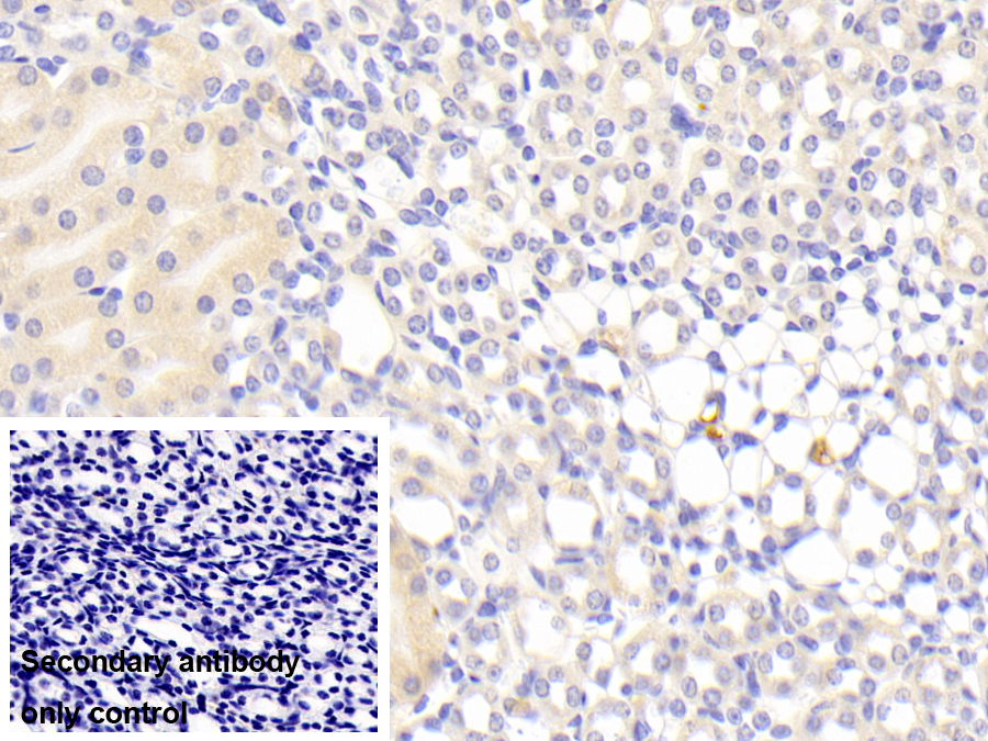 Polyclonal Antibody to Alpha-1-B-Glycoprotein (a1BG)