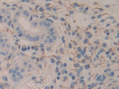 Polyclonal Antibody to Serum/Glucocorticoid Regulated Kinase 3 (SGK3)