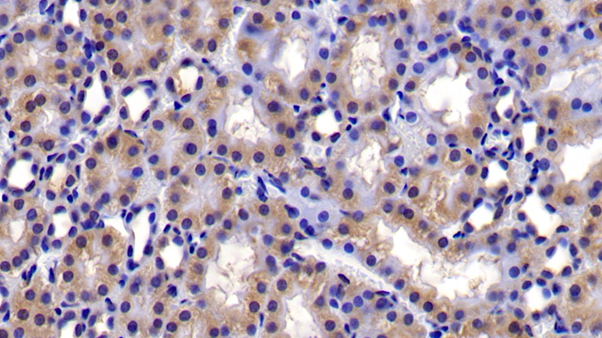 Polyclonal Antibody to B-Cell CLL/Lymphoma 2 Like Protein (Bcl2L)