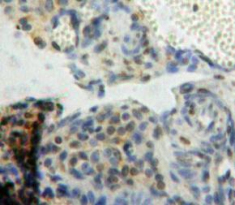 Polyclonal Antibody to B-Cell CLL/Lymphoma 9 (Bcl9)