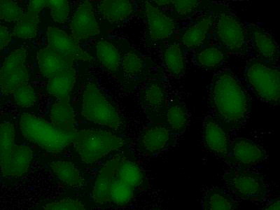 Polyclonal Antibody to Ubiquitin Conjugating Enzyme E2C (UBE2C)