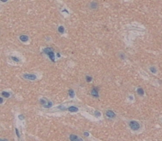 Polyclonal Antibody to Huntingtin Interacting Protein 2 (HIP2)