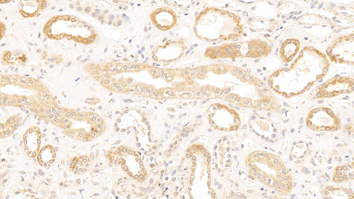 Polyclonal Antibody to Cyclin Dependent Kinase Inhibitor 1A (CDKN1A)