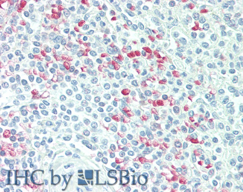 Polyclonal Antibody to Cyclin Dependent Kinase Inhibitor 2D (CDKN2D)