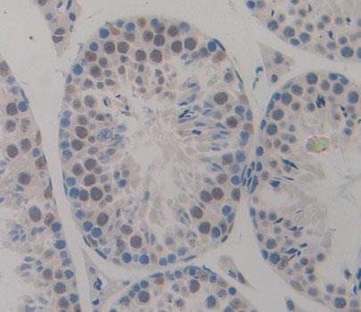 Polyclonal Antibody to Cyclin Dependent Kinase Inhibitor 2D (CDKN2D)