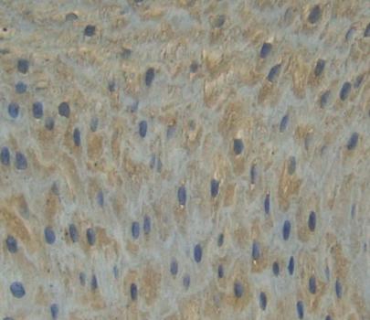 Polyclonal Antibody to Guanylate Binding Protein 6 (GBP6)