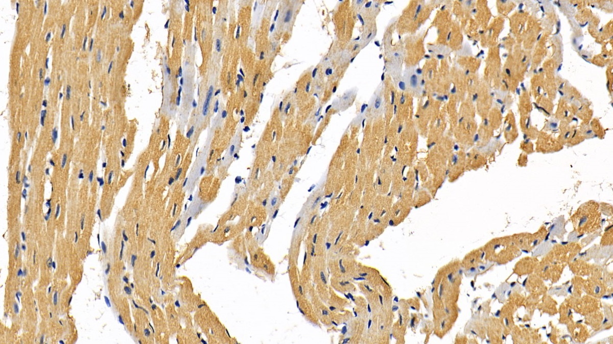 Polyclonal Antibody to Receptor Interacting Serine Threonine Kinase 1 (RIPK1)