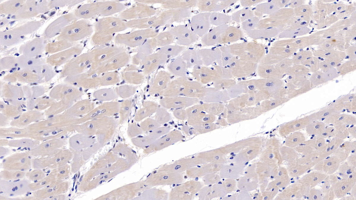 Polyclonal Antibody to FK506 Binding Protein 1A (FKBP1A)