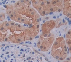 Polyclonal Antibody to FK506 Binding Protein 5 (FKBP5)