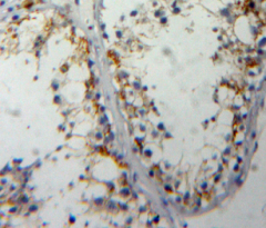 Polyclonal Antibody to Cell Division Cycle Protein 25 (CDC25)