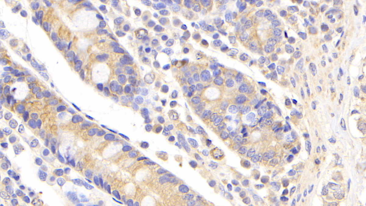 Polyclonal Antibody to Ubiquitin Conjugating Enzyme E2S (UBE2S)