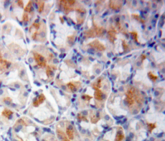 Polyclonal Antibody to SHC-Transforming Protein 1 (SHC1)