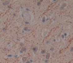 Polyclonal Antibody to Fascin 2 (FSCN2)