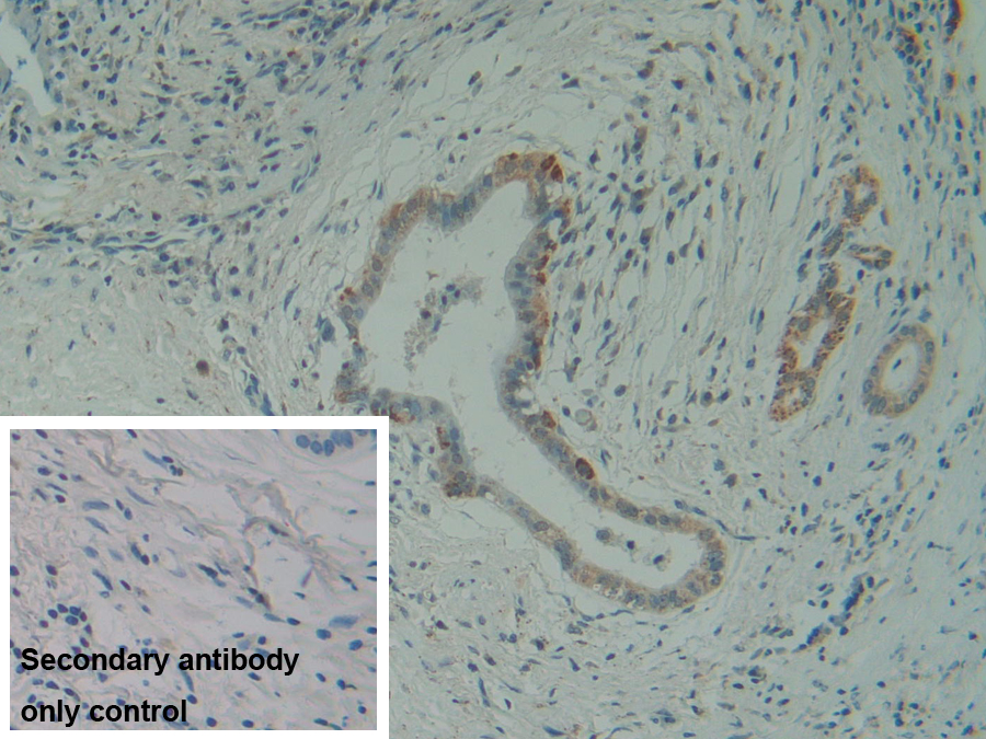 Polyclonal Antibody to Hydroxymethylbilane Synthase (HMBS)