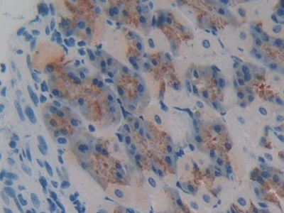 Polyclonal Antibody to Glomulin (GLMN)