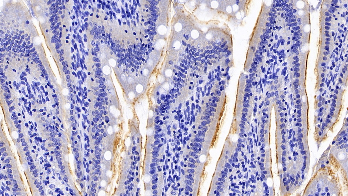 Polyclonal Antibody to N-Acylsphingosine Amidohydrolase 2 (ASAH2)