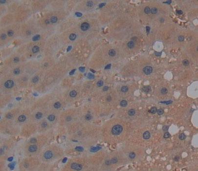 Polyclonal Antibody to Sphingosine Kinase 2 (SPHK2)