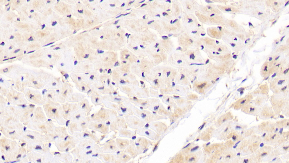 Polyclonal Antibody to Inhibitory Subunit Of NF Kappa B Epsilon (IkBe)