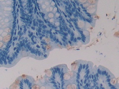 Polyclonal Antibody to Inhibitory Subunit Of NF Kappa B Epsilon (IkBe)