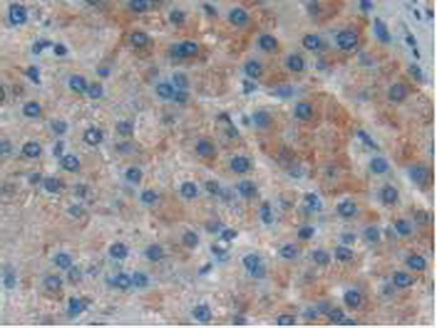 Polyclonal Antibody to Inhibitory Subunit Of NF Kappa B Delta (IkBd)