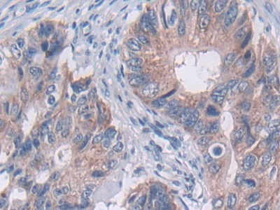 Polyclonal Antibody to Tubulin Delta (TUBd)