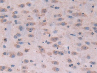 Polyclonal Antibody to Tubulin Epsilon (TUBe)